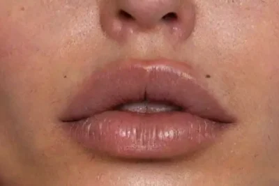 Vertical Labret: Modern Lip Piercing