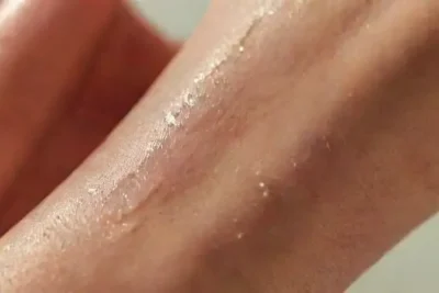 Safe Tattoo and Piercing Aftercare for Allergic Skin Types